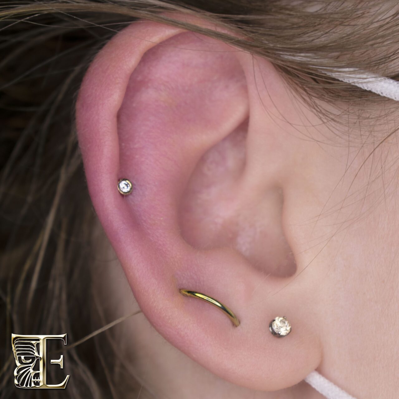 Orbital lobe pierced by Dee with a titanium captive bead ring anodized yellow